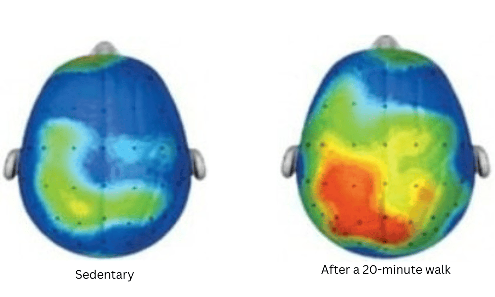 Brain scan comparison showing sedentary versus post-exercise activity